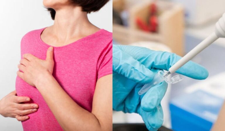 Crean dispositivo que usa muestra de saliva para detectar el cáncer de mama