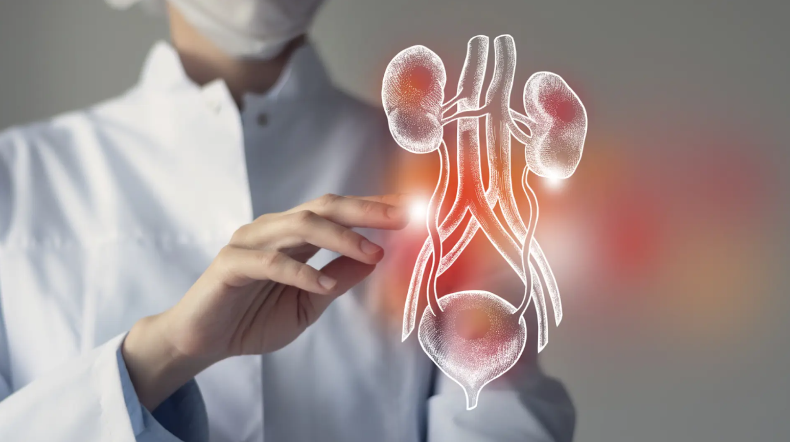 Aumento alarmante de cáncer de vejiga en Talca