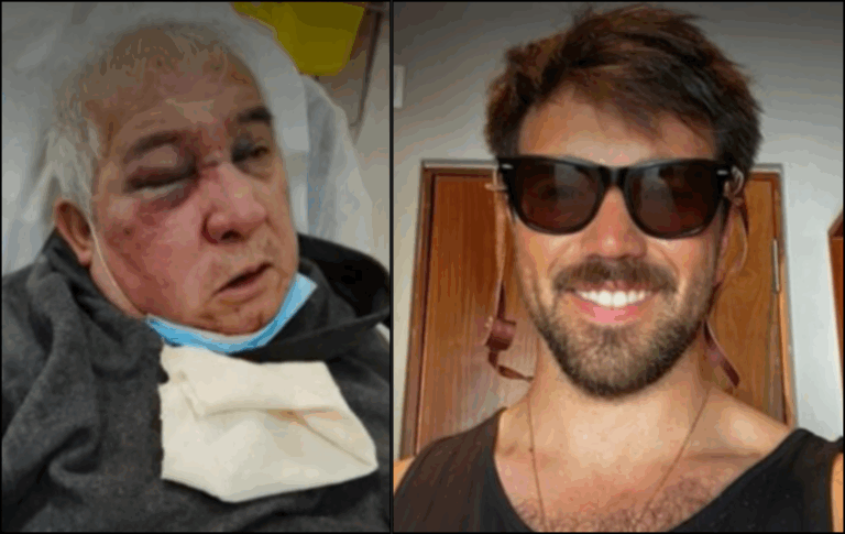 Conserje de 70 años es brutalmente agredido en Vitacura: podría perder un ojo