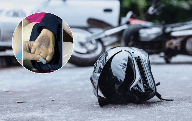 Mujer de 86 años sufre graves fracturas tras ser atropellada por motociclista en Yerbas Buenas