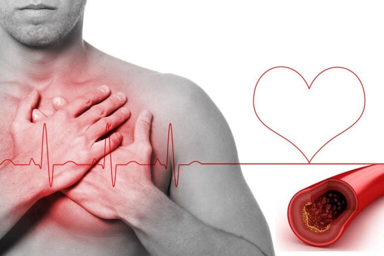 Mes del corazón: enfermedades cardiovasculares causan 28% de las muertes en Chile