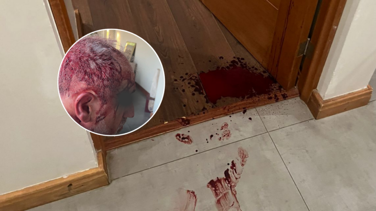 Violento robo en Talca afecta a reconocido académico y a su familia en su vivienda