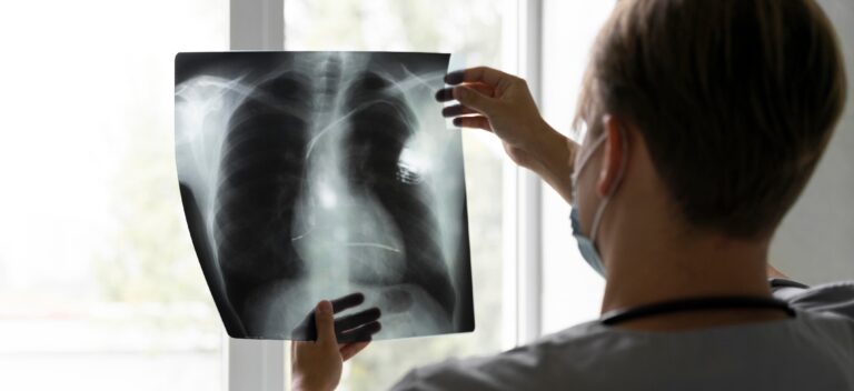 Experta de la UTalca advierte sobre los riesgos y causas de la enfermedad pulmonar obstructiva crónica (EPOC)