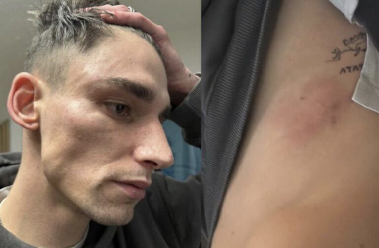 Día internacional contra la homofobia en el fútbol: Justicia para Pascal Kaiser