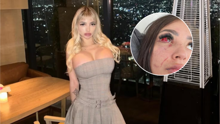 Actriz “Gatita Veve” denuncia presunta agresión de influencer, hijo de Francisco Pacheco: “Quería matarme”